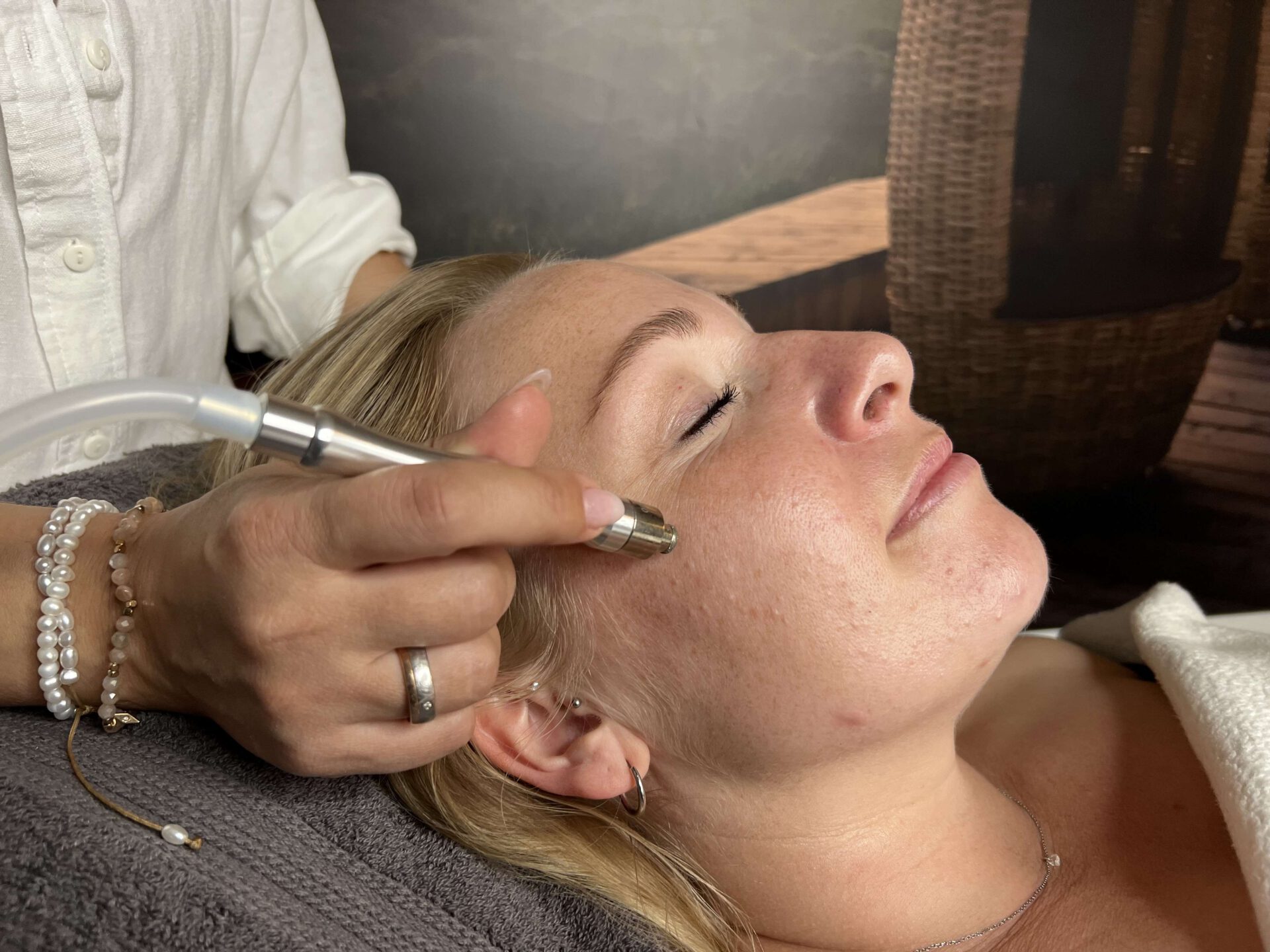 Microdermabrasion Behandlung